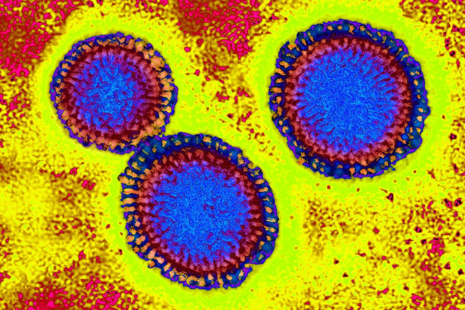 Flu 2020 viruses 1500 D
